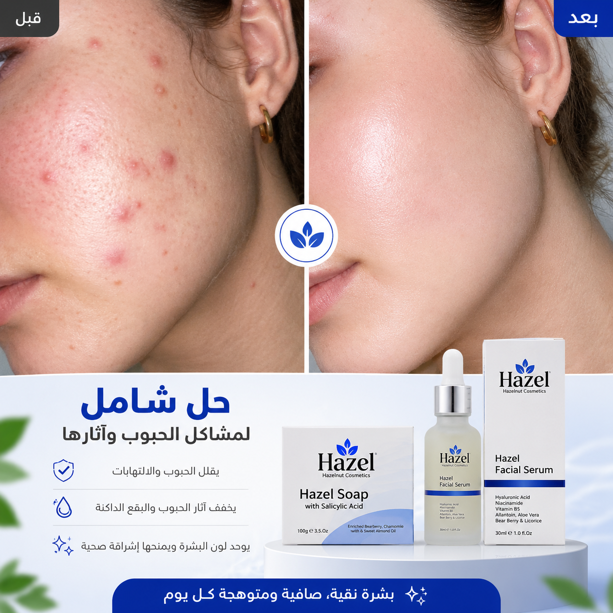 Hazel Serum & Hazel Soap