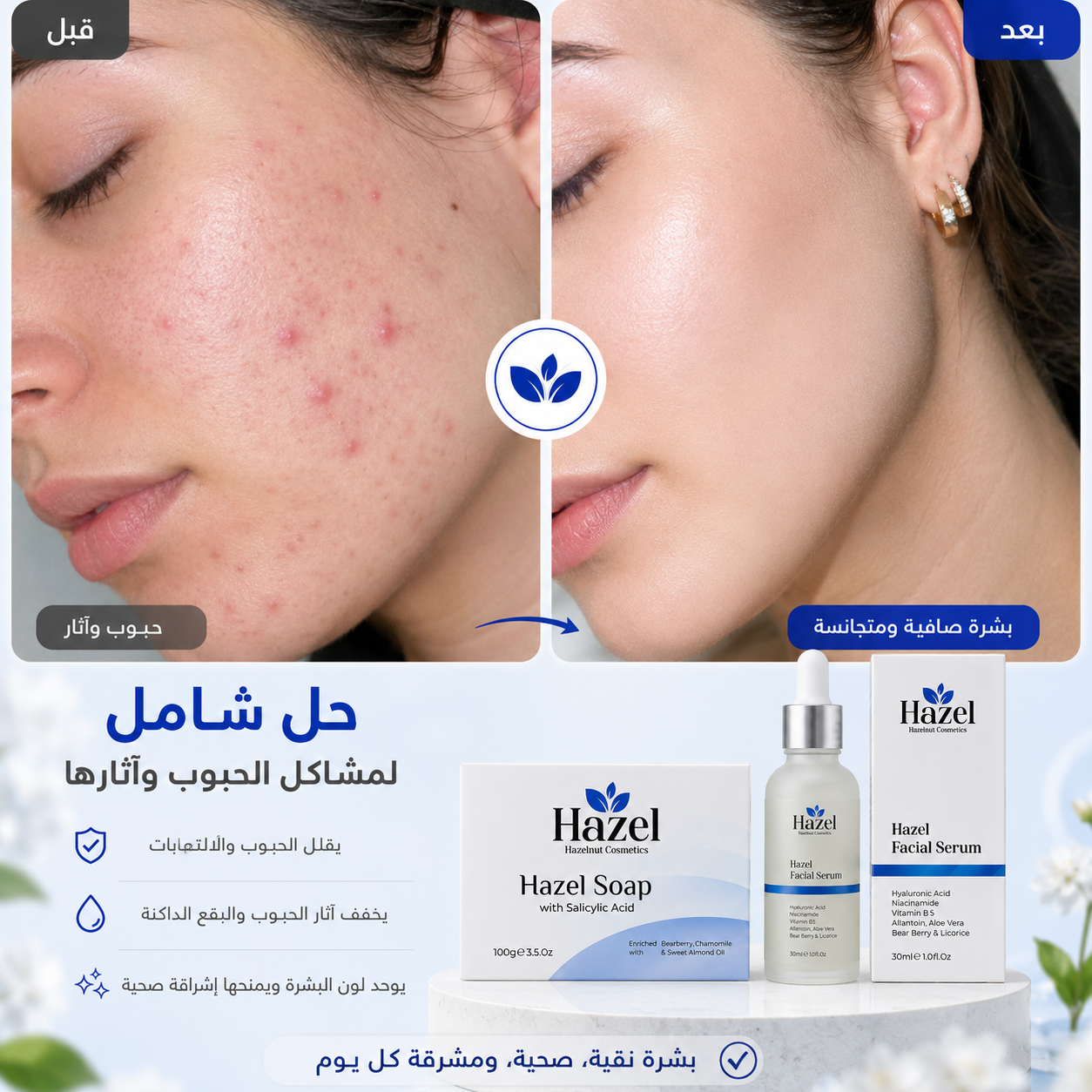 Hazel Serum & Hazel Soap
