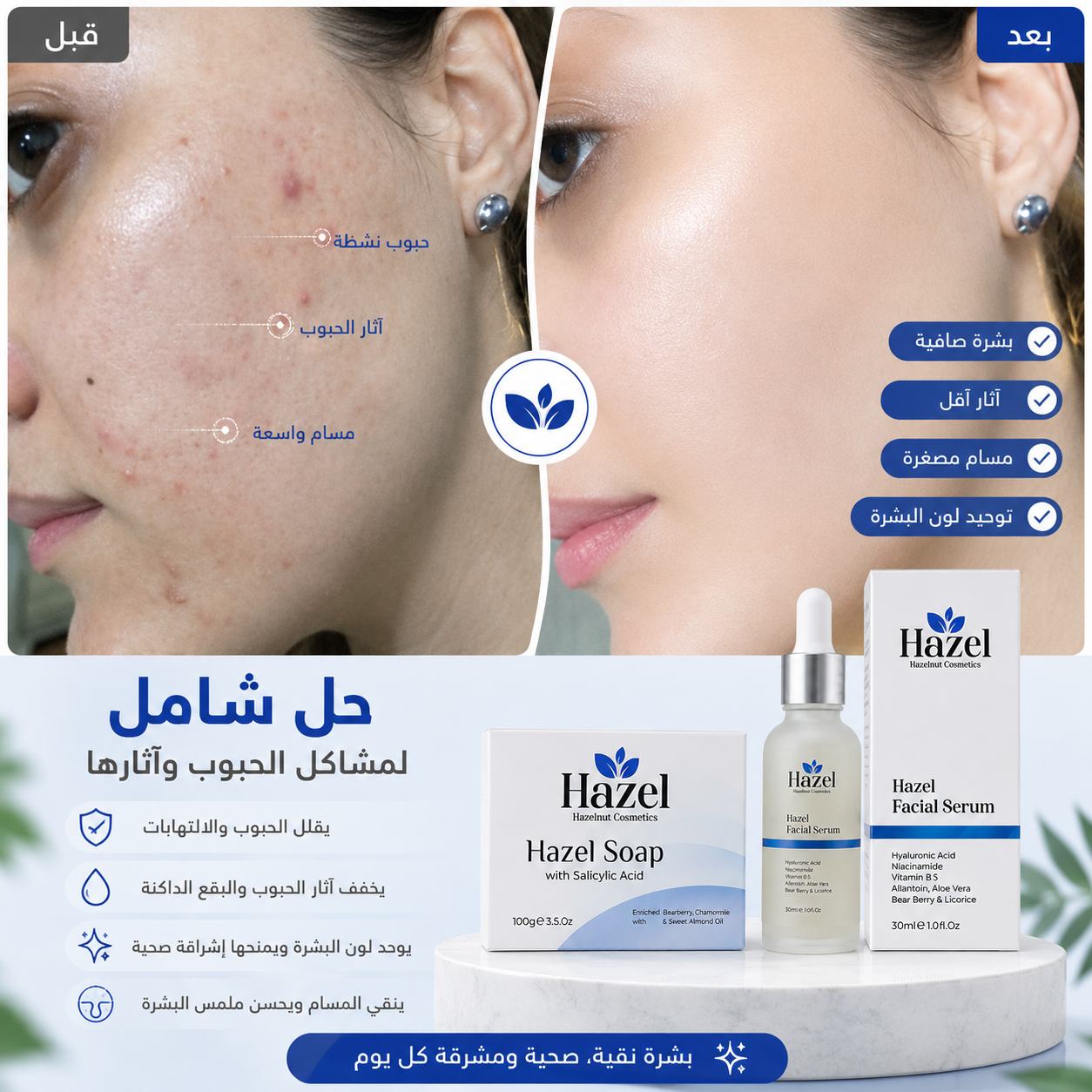 Hazel Serum & Hazel Soap